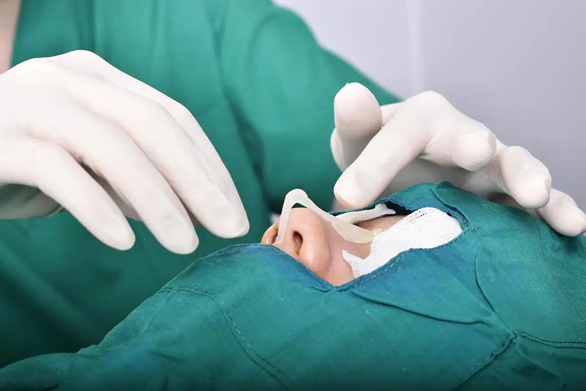 El costo de los materiales para la rinoplastia puede variar según lo que se utilice en la cirugía