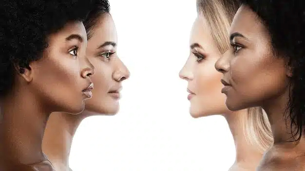 Cuatro mujeres diversas de perfil mostrando diferentes formas nasales, lo que indica variaciones de rinoplastia.