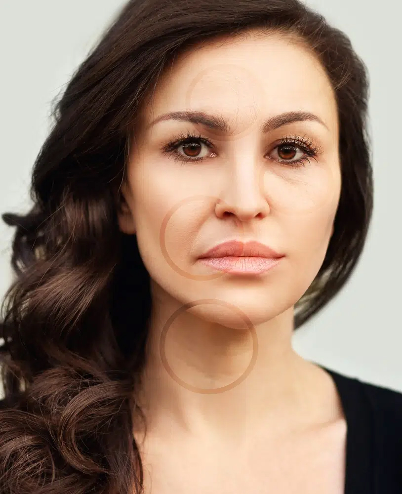 La piel suelta después de una cirugía de lifting facial no necesariamente indica una complicación o un fracaso quirúrgico