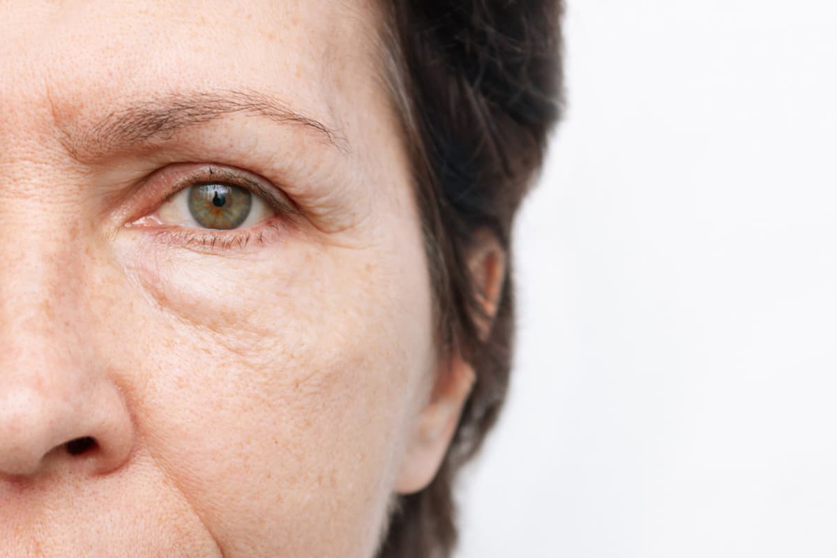 Primer plano del ojo de una mujer madura mostrando bolsas y líneas de expresión, signos que se evalúan para una blefaroplastia.