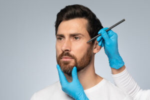 Manos de cirujano evaluando y marcando el rostro de un hombre antes de un lifting facial.
