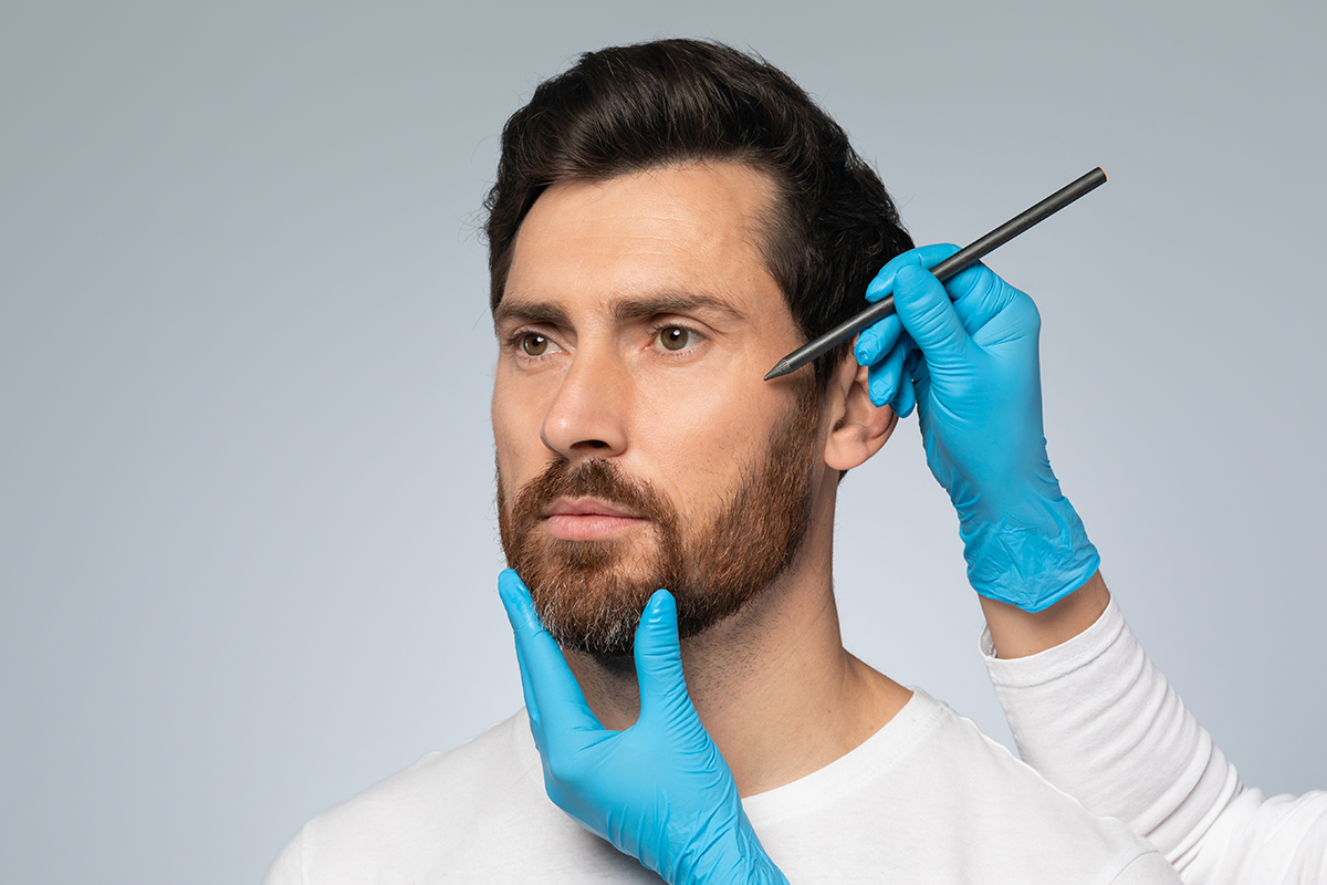 Manos de cirujano evaluando y marcando el rostro de un hombre antes de un lifting facial.