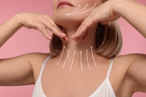 Mujer mostrando el efecto de elevación en cuello y mandíbula tras un lifting facial, indicado con flechas.