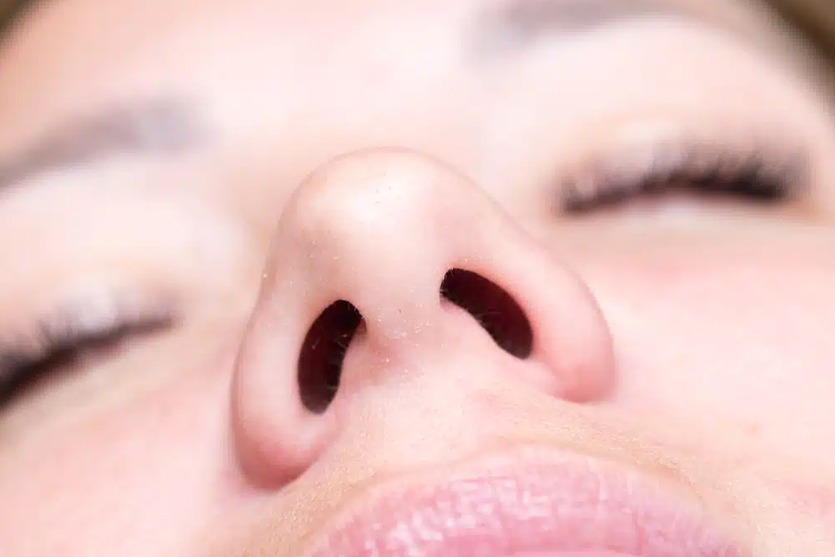 Primer plano desde un ángulo inferior de la nariz de una persona con los ojos cerrados, mostrando la base nasal, las fosas nasales y la columela.